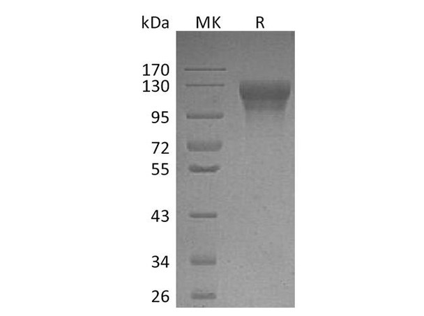 Human LEPR/CD295 Recombinant Protein (RPES1265)