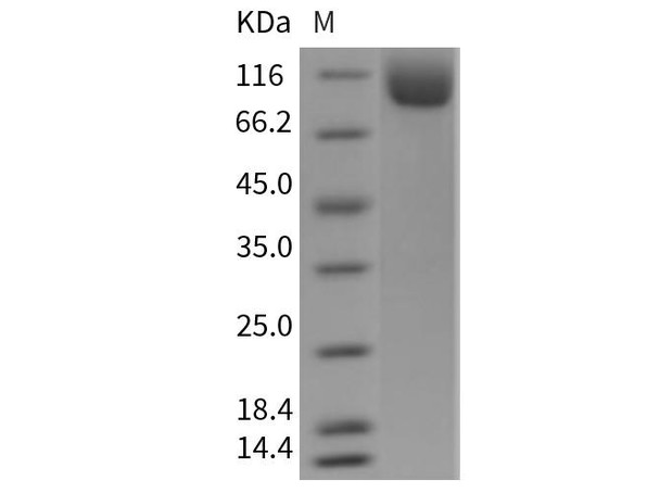 Mouse NAALADL1 Recombinant Protein (His Tag) (RPES1298)
