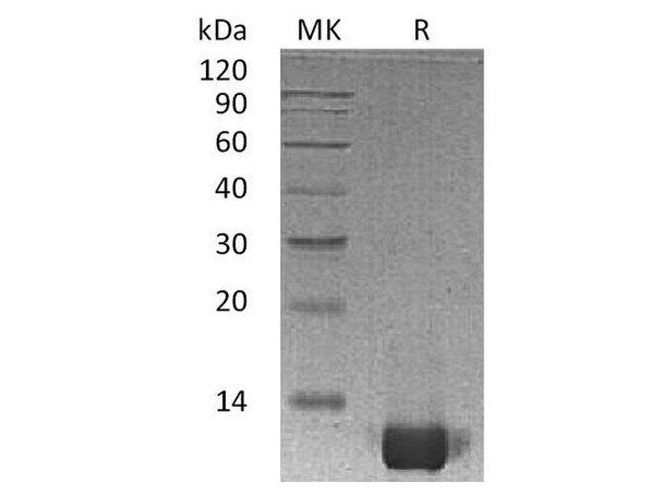 Human IL-8/CXCL8 Recombinant Protein (RPES1302)