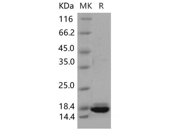 Mouse Peroxiredoxin 5/PRDX5 Recombinant Protein (His Tag) (Active) (RPES1309)