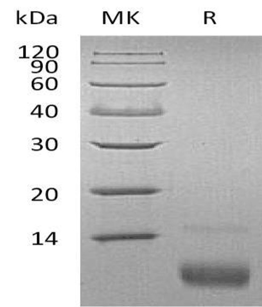 Human CXCL12/SDF Recombinant Protein (RPES1312)