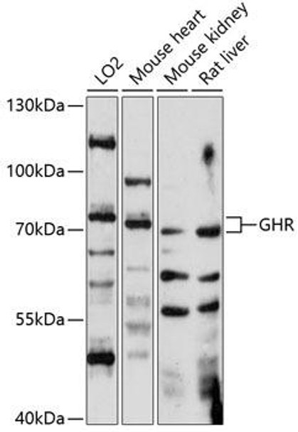 Anti-GHR Antibody (CAB14735)