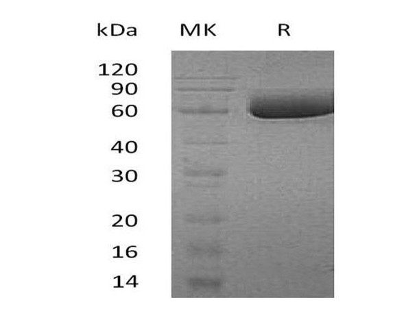 Human SMPDL3A Recombinant Protein (RPES1319)