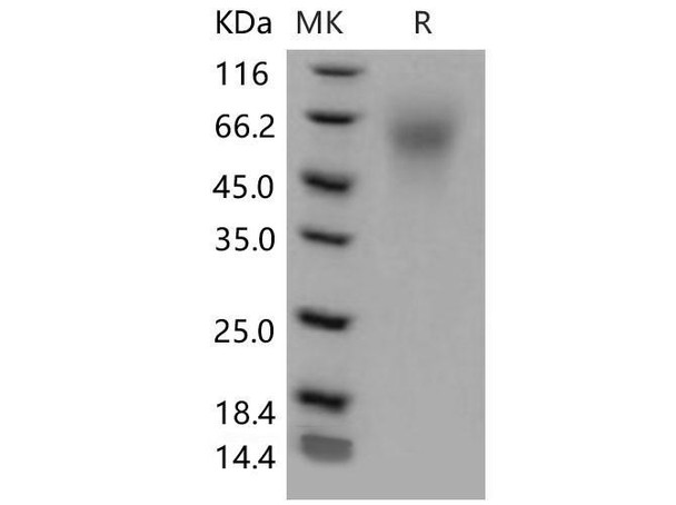 Mouse LYPD3 Recombinant Protein (His Tag) (Active) (RPES1326)