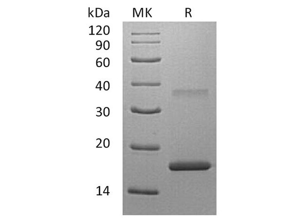 Human Interleukin-7/IL-7 Recombinant Protein (Active) (RPES1338)