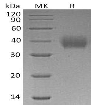 Human CD89/FCAR Recombinant Protein (RPES1349)