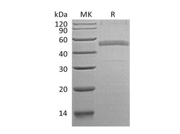 Human Calumenin Recombinant Protein (RPES1356)