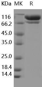 C2/Complement Component 2 Recombinant Protein (RPES1363)