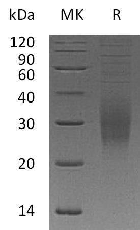 Human TREM2 Recombinant Protein (RPES1370)
