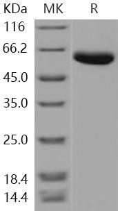 Human Carboxypeptidase B2/CPB2 Recombinant Protein (His Tag) (RPES1380)
