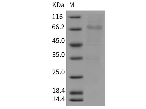 Mouse GFRA3/GFR-alpha-3 Recombinant Protein (Fc Tag) (RPES1390)