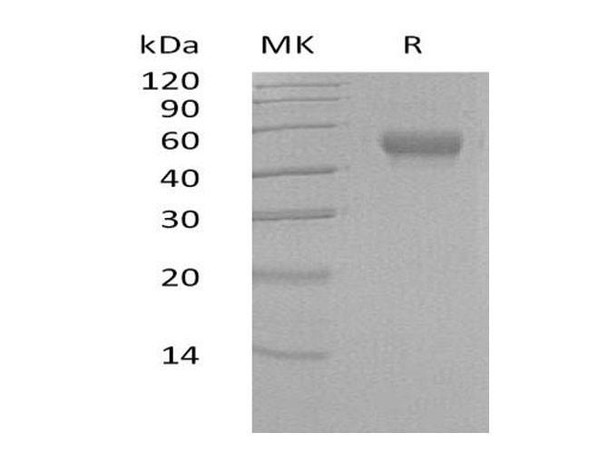 Human LRG1 Recombinant Protein (RPES1395)