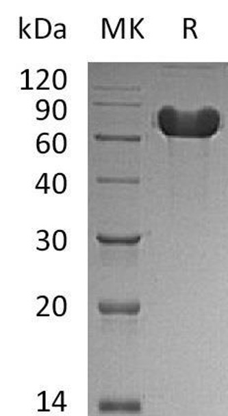 Human GOLPH2/GOLM1 Recombinant Protein (aa 40-401, His Tag) (RPES1398)