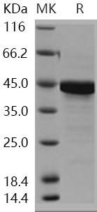 Human PTMA Recombinant Protein (GST Tag) (RPES1424)