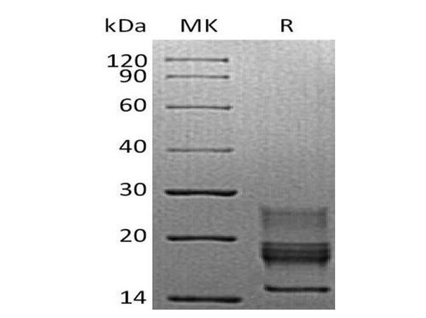 Mouse Interferon gamma/IFNG Recombinant Protein (RPES1431)