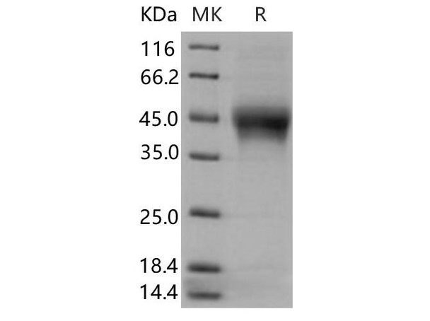 Human IL-21R Recombinant Protein (RPES1438)