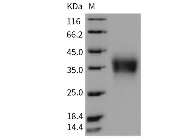 Rat CD32b/FCGR2B Recombinant Protein (RPES1480)