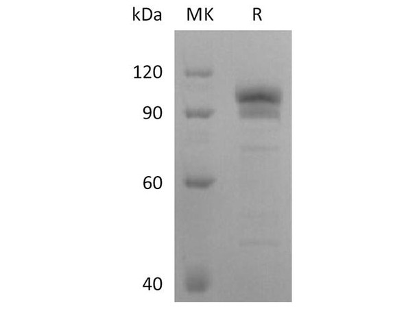 Human EphB2 Recombinant Protein (RPES1483)