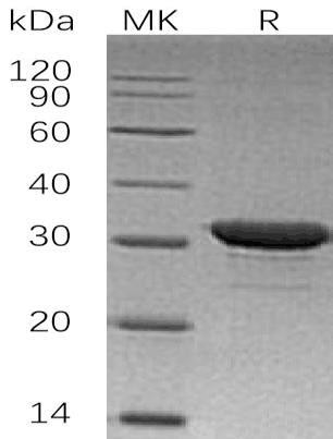 Human IMP1/IMPA1 Recombinant Protein (RPES1485)