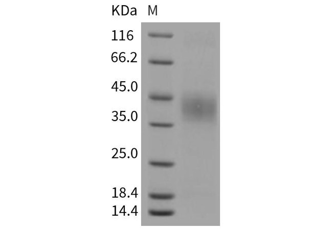 Mouse EPCR Recombinant Protein (His Tag) (RPES1488)