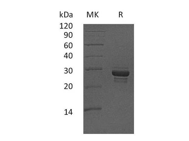 Human CALCB Recombinant Protein (RPES1492)