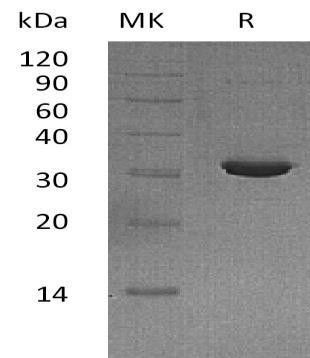 Human IMPA2/IMPase 2 Recombinant Protein (RPES1504)