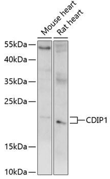 Anti-CDIP1 Antibody (CAB14883)