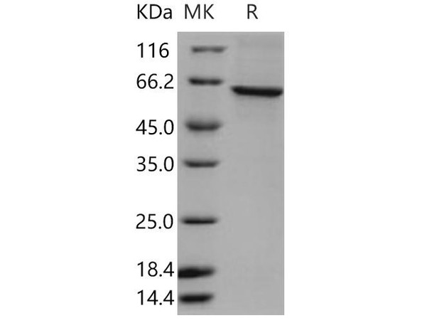 Human TERF1/TRF1 Recombinant Protein (His Tag) (RPES1515)