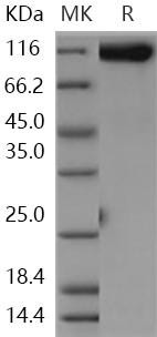 Human GPNMB Recombinant Protein (Fc Tag) (RPES1541)