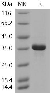 Human AKR1B1 Recombinant Protein (His Tag) (RPES1560)