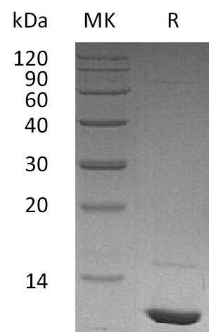 Human IGF/IGF1 Recombinant Protein (Active) (RPES1563)