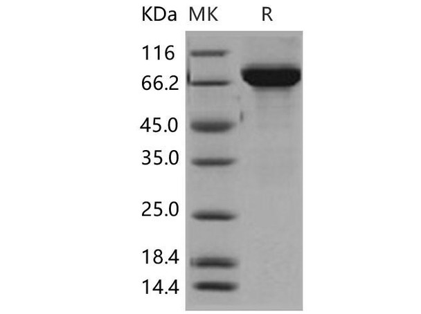 Human TH/Tyrosine Hydroxylase Recombinant Protein (His Tag) (RPES1576)