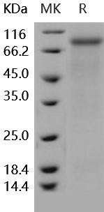 Human MEP1A/PPHA Recombinant Protein (RPES1577)