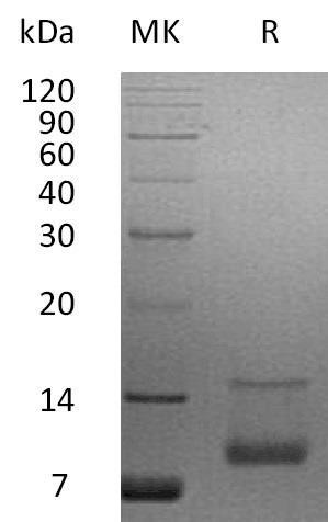 Human IGF/IGF1 Recombinant Protein (RPES1582)