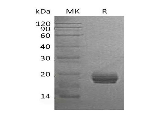 Human GM2A Recombinant Protein (RPES1589)