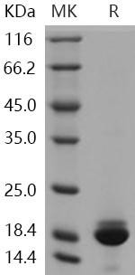 Human PRDX5 Isoform cytoplasmic + peroxisomal Recombinant Protein (His Tag) (RPES1638)