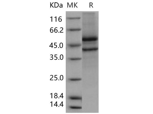 Human SPOCK1/Testican 1 Recombinant Protein (aa 21-429, His Tag) (RPES1655)