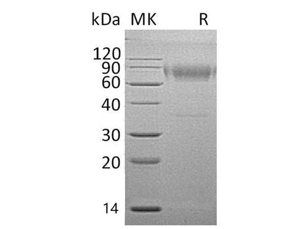 Mouse IL18BP Recombinant Protein (RPES1666)