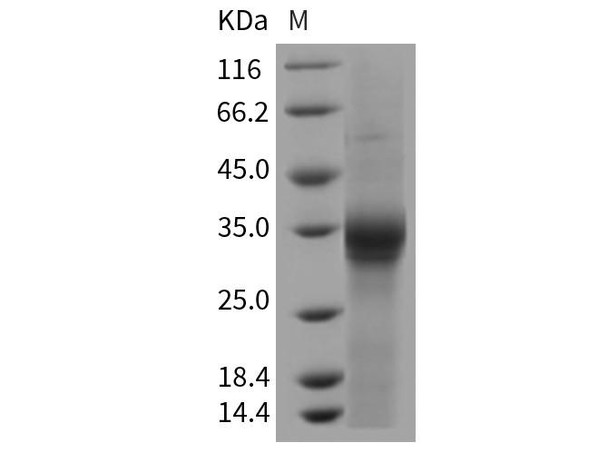 Rat IL20RB Recombinant Protein (His Tag) (RPES1698)