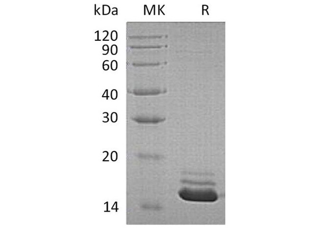 Human Cystatin C/CST3 Recombinant Protein (RPES1701)