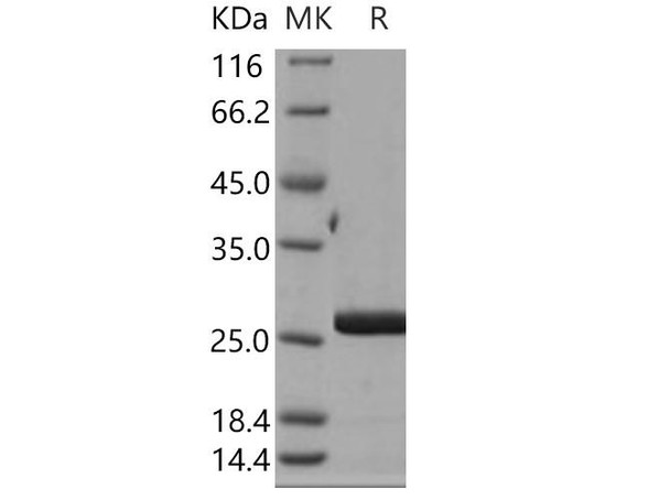 Human CRADD/RAIDD Recombinant Protein (His Tag) (RPES1734)