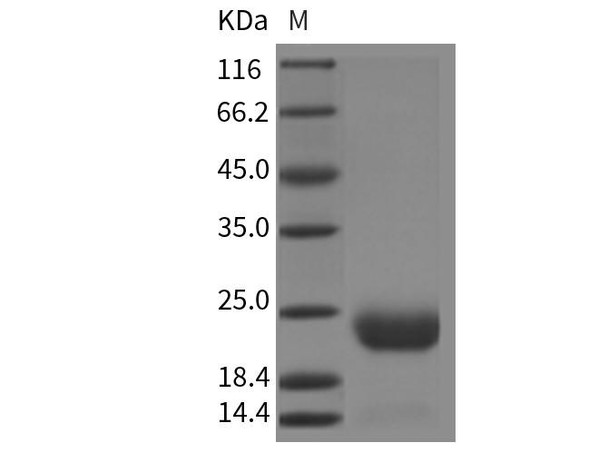 Mouse CCDC47 Recombinant Protein (His Tag) (RPES1757)