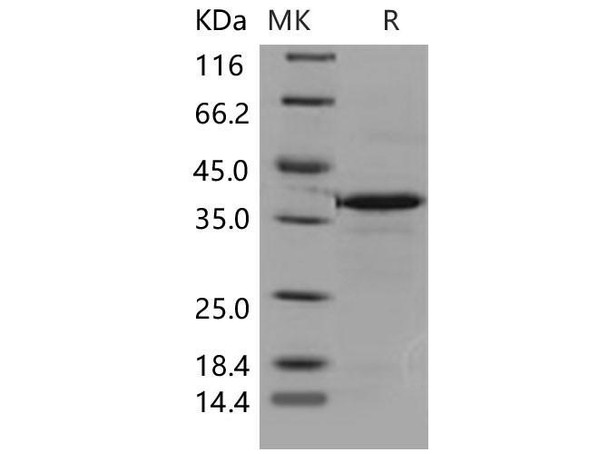 Mouse Carbonic Anhydrase VIII/CA8 Recombinant Protein (His Tag) (Active) (RPES1764)