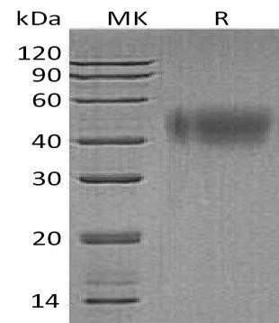 Human IFNAR2 Recombinant Protein (RPES1781)