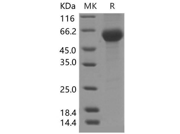 Mouse PLA2G7/Lp-PLA2 Recombinant Protein (His Tag) (RPES1797)