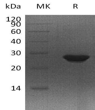 Human MTHFS Recombinant Protein (RPES1800)