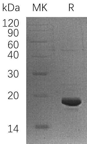 Human LSM1 Recombinant Protein (RPES1804)