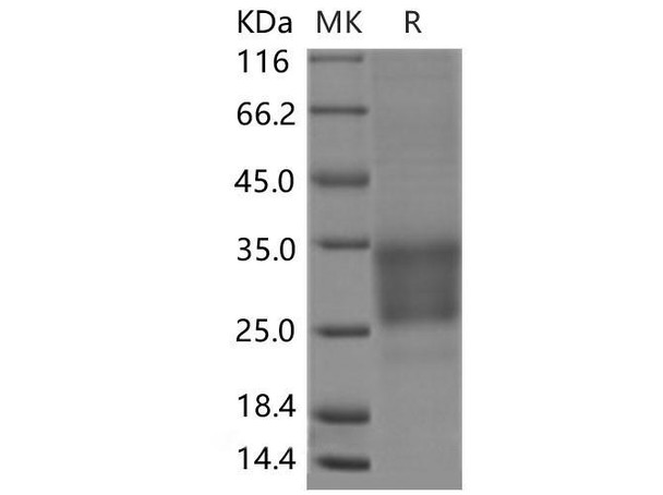 Mouse CD69 Recombinant Protein (His tag, ECD) (RPES1805)