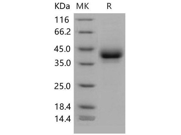 Mouse CD209B/DC-SIGNR1 Recombinant Protein (His Tag) (RPES1818)