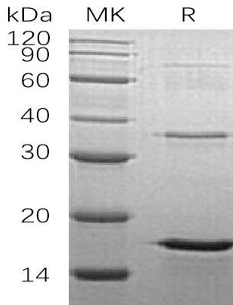 Human LSM4 Recombinant Protein (RPES1824)